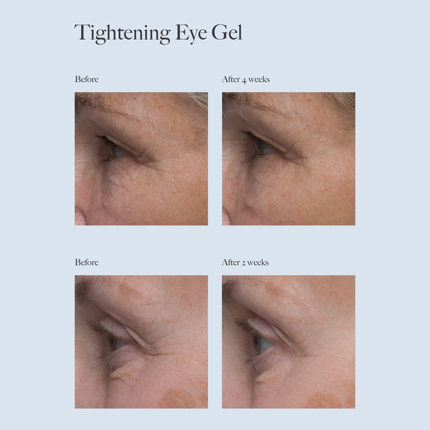 Dr Loretta Tightening Eye Gel Sunja Link Body Shoppe Canada